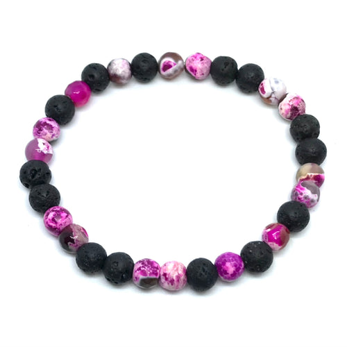 6mm Marbled Fuchsia Agate Diffuser Bracelet